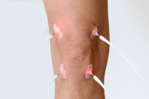 Knee Treatment with FSM Frequency Specific Microcurrent