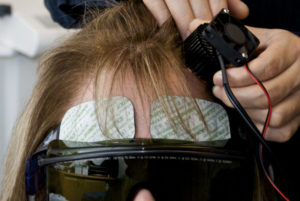 photobiomodulation behavioral brain functions