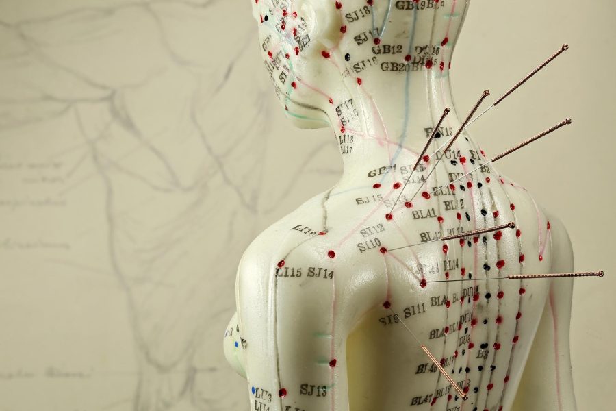Acupuncture model with needles in the shoulder Sutherland House