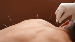 Acupuncture for Men Sutherland House