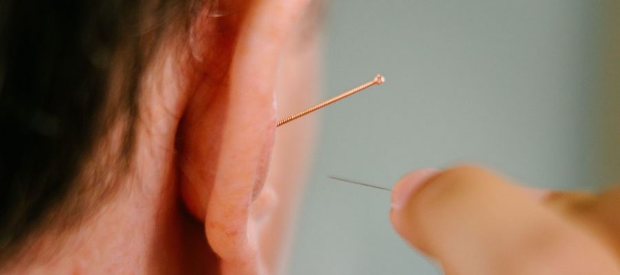 Ear acupuncture 2